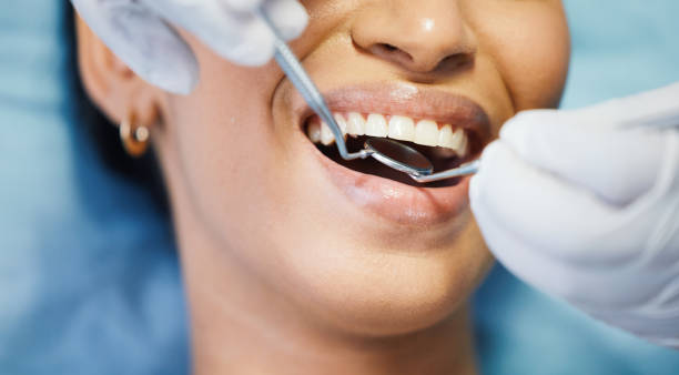 Best Emergency Tooth Extraction in Salem, VA